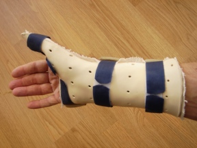 My splint